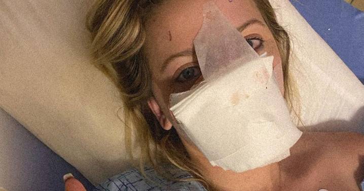 Mum who had nose bitten off and 'swallowed' by dog reveals face after 16 surgeries