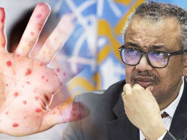 OMS: Muertes por sarampión bajan en un 88% pero contagios están en aumento