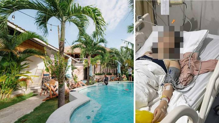 Bali: Tourist details near-death experience at Canggu hostel after mass illness event kills one