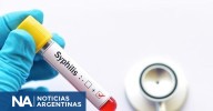 Alerta sífilis: los casos se incrementaron un 20,5% en Argentina