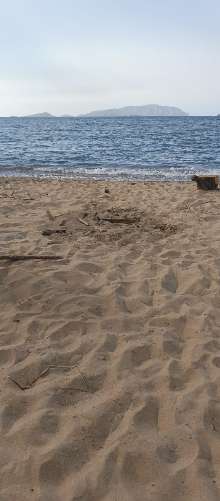 Exigen justicia para niña que sufrió quemaduras por restos de una fogata en Puerto Morro