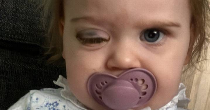 'We noticed change in daughter's eye - diagnosis left us in tears'