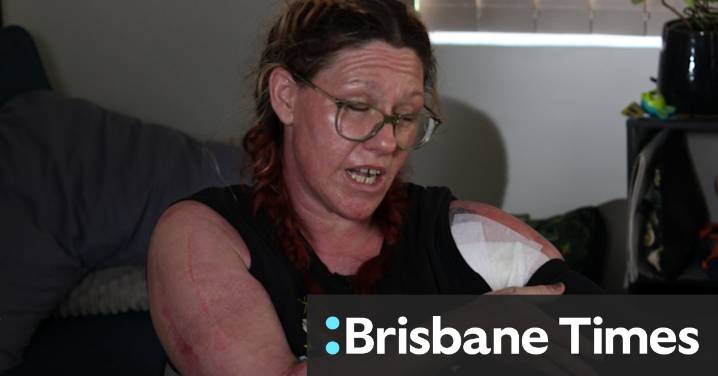 Greenfields firebomb attack: WA mum describes moment she was engulfed in flames