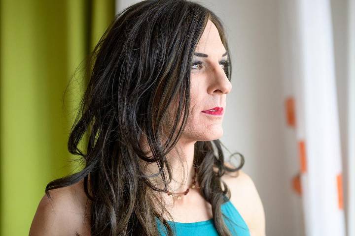 CV Risk Not Increased With Gender-Affirming Hormone Therapy Use in Transgender Women