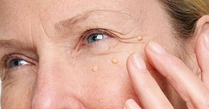 Amazon slashes eye cream that instantly tightens' crow's feet and 'knocks 10 years off' to £13 ahead of Cyber Monday