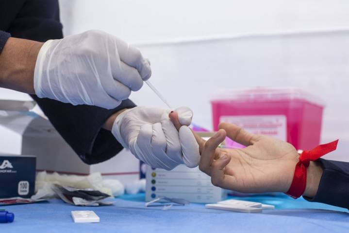 Día Mundial contra el SIDA: dónde hacerte la prueba rápida de VIH este 1 de diciembre