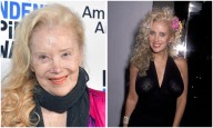 Veteran actress Sally Kirkland, known for 'Anna,' in hospice