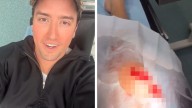 Big Time Rush's Logan Rushed to Hospital After Slicing Open Knee Onstage, See Pic
