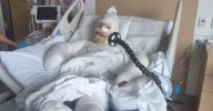 'Like being fried': West Australian mum suffers serious burns in firebombing