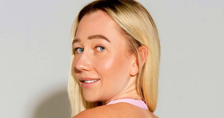 'I just wanted to be normal - now I wear my condition on my sleeve'