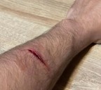 Un perro suelto atacó a un vecino en la plaza 14 de Octubre y buscan al dueño