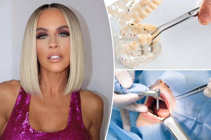 Inside Jenny McCarthy's infections from a failed dental implant