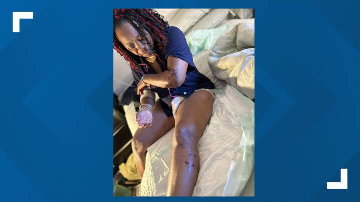 Metro Atlanta hairdresser attacked by dog following appointment