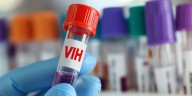 VIH en América Latina: qué dicen los expertos sobre el acceso a la prevención y al tratamiento