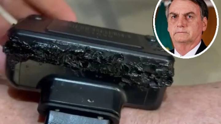 El hijo de Bolsonaro atribuye a la "desesperación" el intento de su padre de manipular la tobillera