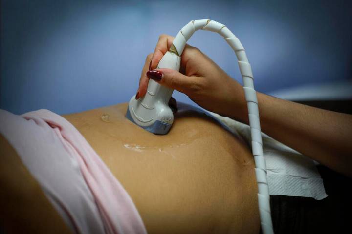 El Gobierno denuncia a Madrid por la lista de objetores del aborto