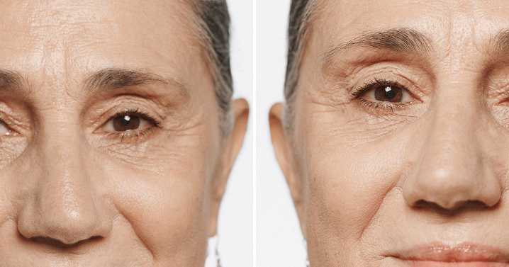 Clinique launches 'biggest ever' Black Friday sale reducing 'age