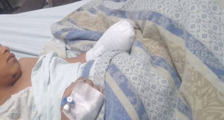 Huancayo: Menor que perdió la mano izquierda requiere de acompañamiento psicológico integral