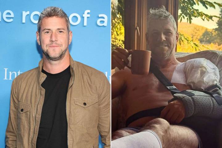 Ant Anstead Injures Himself in ‘Freak’ Accident While Playing Soccer