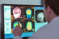 Un estudio asegura que la adolescencia dura hasta los 32 años