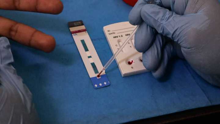 Casos de VIH son Diagnosticados Demasiado Tarde, Advierte la OMS