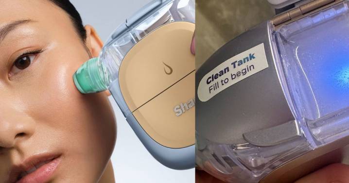 I put Shark's hydro-extraction tool to the test– what came out of my pores shocked me