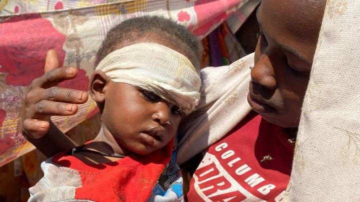 Sudan 'epicentre of suffering in the world', says UN humanitarian chief
