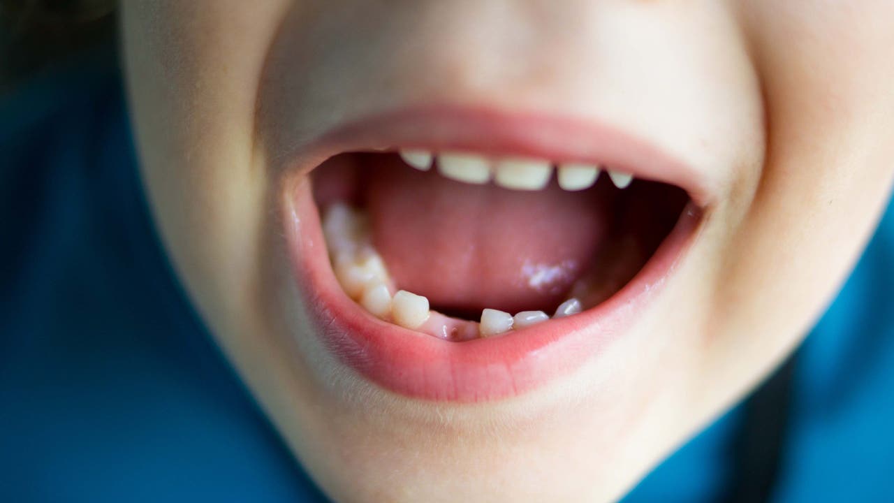 FDA puts restrictions on fluoride use for kids