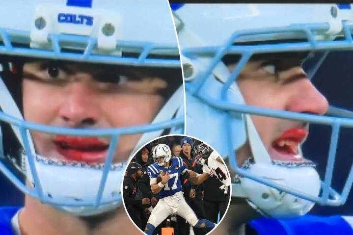 Daniel Jones left bleeding from his mouth on Colts' game