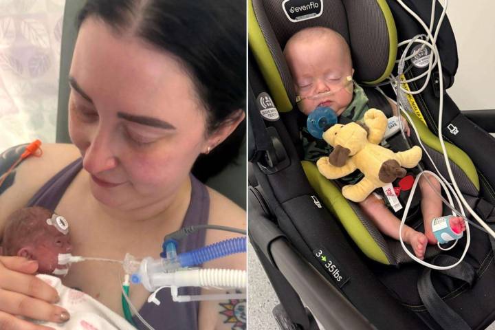 Micropreemie Had 10% Chance of Survival After Mom Gave Birth at 22 Weeks (Exclusive)