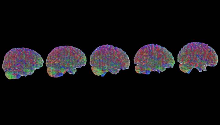 Scientists Behind World-First Study Say The Human Brain's Lifespan Is Divided Into 5 Eras