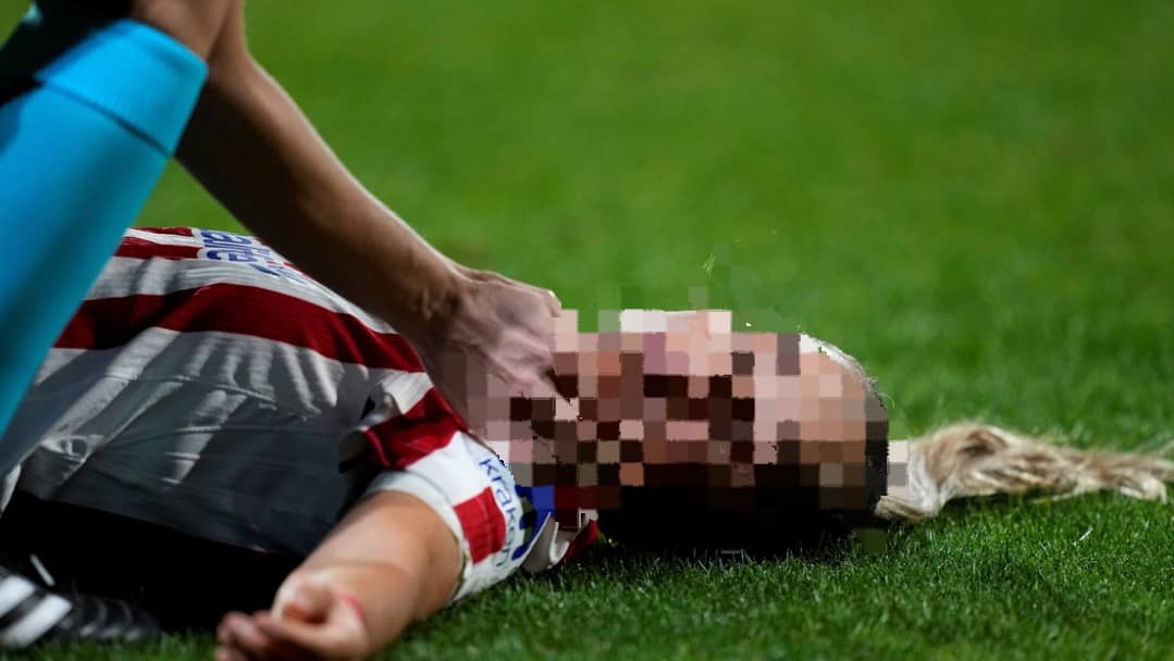 Futbolista queda inconsciente en pleno partido tras recibir un rodillazo en la cabeza (+Foto)