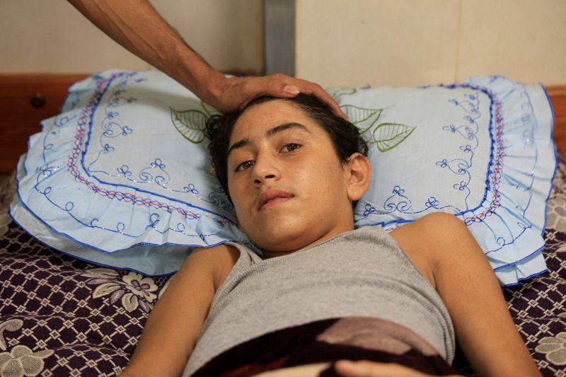 Gaza patients face a painful wait as hospitals sag under burden of cases