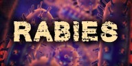 2 people exposed to rabies in Watertown