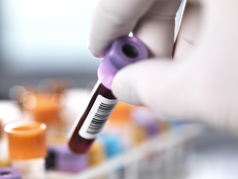 CRISPR gene-editing works to reduce high cholesterol in a new study