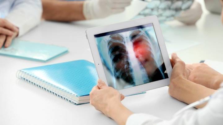 Baptist Health System unveils robotic-assisted lung biopsy device to help detect cancer early