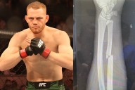 Jack Della Maddalena’s Broken Arm at UFC 299: How He Beat Gilbert Burns With Fractured Forearm