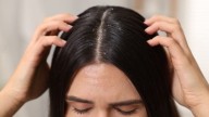 Flaky Scalp and Dandruff Season: A Dermatologist’s Guide to a Healthy Winter Scalp
