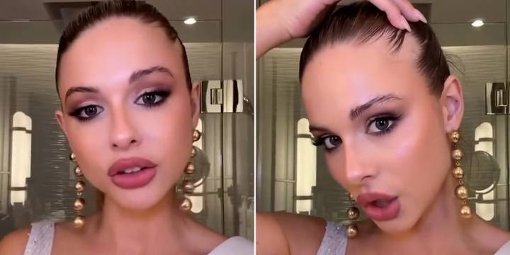 Alopecia: los detalles de la afección que tiene Aldana Masset, representante argentina en Miss Universo 2025