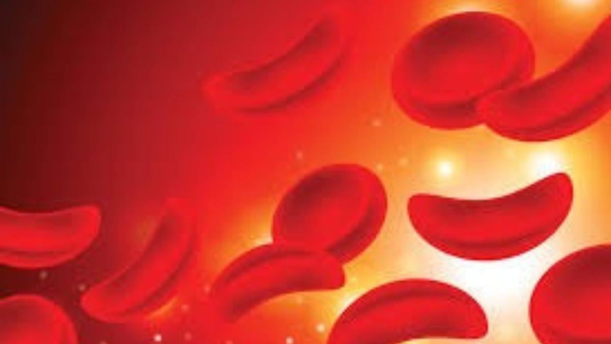 India launches landmark CRISPR gene therapy: A new era for sickle cell disease treatment