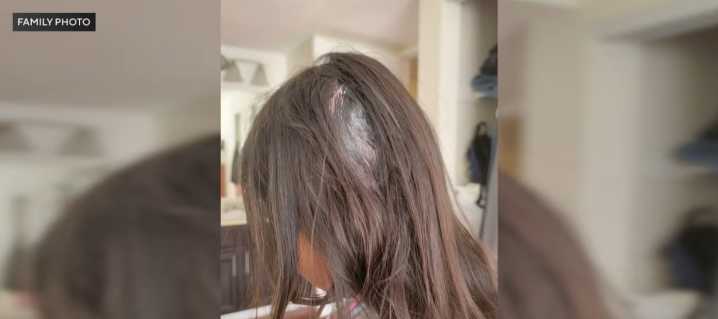 8-Year-Old Girl Wounded After Neighbor’s Gunfire Breaks Through Wall