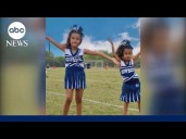 Conjoined twins needed 12-hour separation surgery — now they're cheering