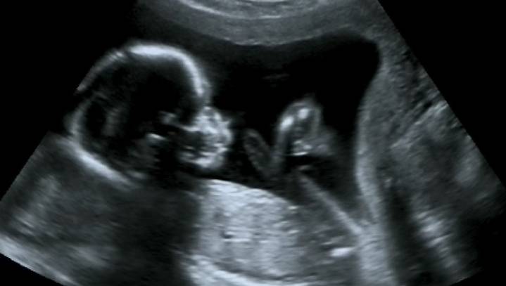 Update: 3,000 New Deaths Today But Enough About Abortion