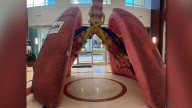 Giant ‘Mega Lung’ turns heads at START Cancer Center to raise awareness