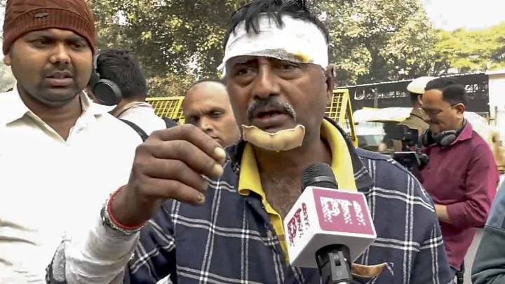 Delhi Red Fort blast: Death toll rises to 12