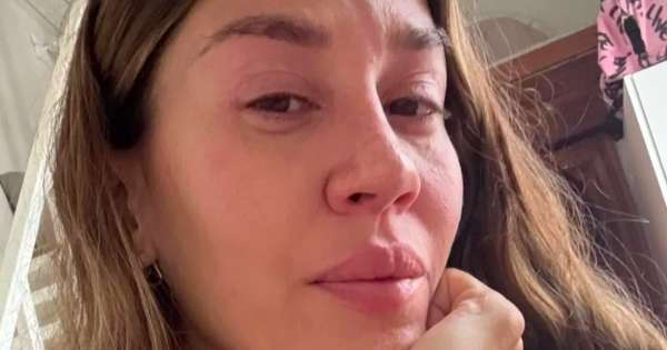 La enfermedad que le detectaron a Jimena Barón: ella confesó todo a sus fanáticos