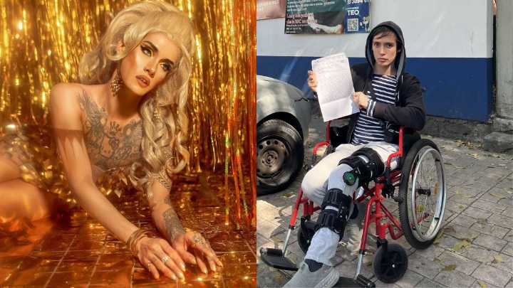 Drag queen Genn Taft denuncia accidente en Uber Moto que le puede dejar sin caminar bien