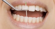 Adiós a los empastes: un gel consigue restaurar los dientes en dos semanas