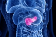 Main Pancreatic Duct Dilation Increases Odds for Neoplastic Progression in High