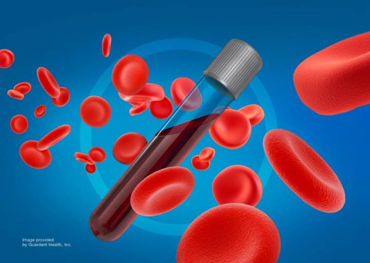 Austin health tech firm provides blood tests at local church